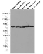 HYAL1 Monoclonal antibody proteintech 66560-1-Ig