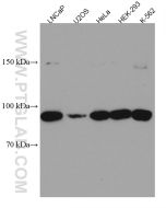 FBXO11 Monoclonal antibody proteintech 67365-1-Ig