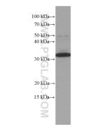 MMACHC Monoclonal antibody proteintech 66609-1-Ig