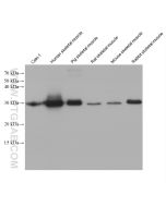 CA3 Monoclonal antibody proteintech 66608-1-Ig
