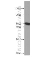 Fibrinogen Beta Chain Monoclonal antibody proteintech 66186-1-Ig