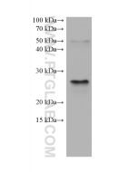 BNIP3 Monoclonal antibody proteintech 68091-1-Ig