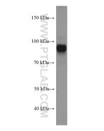 PROX1 Monoclonal antibody proteintech 67438-1-Ig