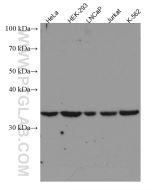 Cyclin C Monoclonal antibody proteintech 67415-1-Ig