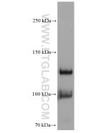 VE-cadherin/CD144 Monoclonal antibody proteintech 66804-1-Ig