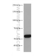 GCK Monoclonal antibody proteintech 67216-1-Ig