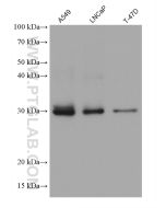 TST Monoclonal antibody proteintech 66018-1-Ig