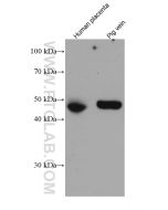 PROCR/EPCR/CD201 Monoclonal antibody proteintech 67658-1-Ig
