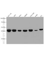 Cytokeratin 18 Monoclonal antibody proteintech 66187-1-Ig