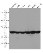 CCT8 Monoclonal antibody proteintech 67539-1-Ig