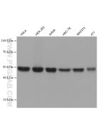 HNRNPH1 Monoclonal antibody proteintech 67375-1-Ig