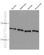 L1CAM/CD171 Monoclonal antibody proteintech 67115-1-Ig