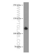 CD41 Monoclonal antibody proteintech 60350-1-Ig