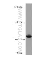 NEDD4L Monoclonal antibody proteintech 67276-1-Ig