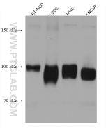 ALCAM Monoclonal antibody proteintech 67768-1-Ig