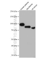 SERPING1/C1 Inactivator Monoclonal antibody proteintech 66882-1-Ig