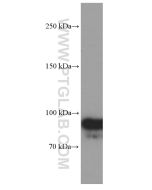 OTUD7B Monoclonal antibody proteintech 66276-1-Ig