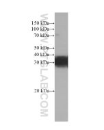 RGS4 Monoclonal antibody proteintech 66441-1-Ig