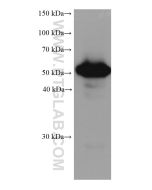 ALDH3A1 Monoclonal antibody proteintech 68036-1-Ig