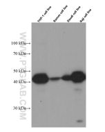 HLA-E Monoclonal antibody proteintech 66530-1-Ig