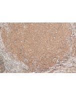 ALK Monoclonal antibody proteintech 60321-1-Ig