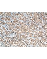Napsin A Monoclonal antibody proteintech 60259-2-Ig