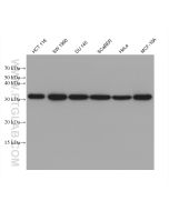 Annexin A3 Monoclonal antibody proteintech 66405-1-Ig
