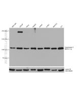 Hexokinase 2 Monoclonal antibody proteintech 66974-1-Ig