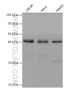 AHCY Monoclonal antibody proteintech 66019-1-Ig