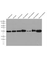 Calbindin-D28k Monoclonal antibody proteintech 66394-1-Ig