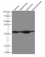 GNMT Monoclonal antibody proteintech 67294-1-Ig