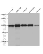 ACTN2 Monoclonal antibody proteintech 68223-1-Ig