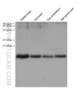 S100B Monoclonal antibody proteintech 66616-1-Ig