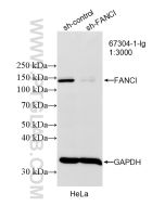 FANCI Monoclonal antibody proteintech 67304-1-Ig