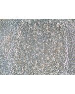 IL-28A Monoclonal antibody proteintech 60270-1-Ig