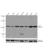DIS3L2 Monoclonal antibody proteintech 67623-1-Ig
