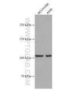 DLC1 Monoclonal antibody proteintech 66894-1-Ig