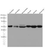 ASL Monoclonal antibody proteintech 67692-1-Ig
