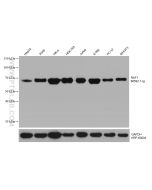 RAF1 Monoclonal antibody proteintech 66592-1-Ig