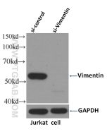 Vimentin Monoclonal antibody proteintech 60330-1-Ig