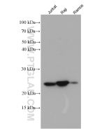 PSMB8 Monoclonal antibody proteintech 66759-1-Ig