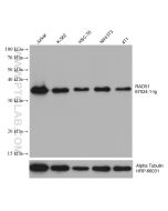 RAD51 Monoclonal antibody proteintech 67024-1-Ig