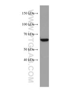 ACSM5 Monoclonal antibody proteintech 67334-1-Ig