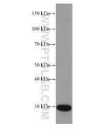 C1QA Monoclonal antibody proteintech 67063-1-Ig