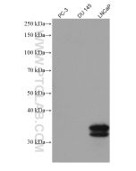 KLK3/PSA Monoclonal antibody proteintech 60338-1-Ig
