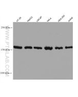 EPRS Monoclonal antibody proteintech 67712-1-Ig