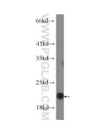 IL-10 Monoclonal antibody proteintech 60269-1-Ig