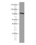 FGL2 Monoclonal antibody proteintech 67152-1-Ig