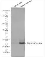 TSG101 Monoclonal antibody proteintech 67381-1-Ig