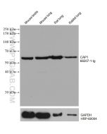 CAP1 Monoclonal antibody proteintech 68207-1-Ig